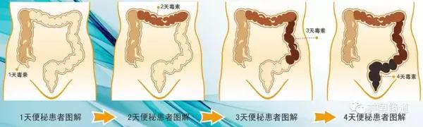 关爱肠道健康 更关心你 美国筠道