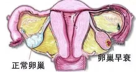 卵巢早衰:  成熟女性一生中固定只有400~500个卵泡发育成熟并排卵,40