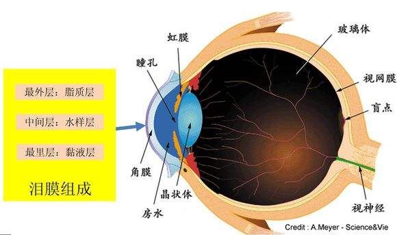 干眼症简单来说就是由于泪液的量或流动异常引起的眼部不适.