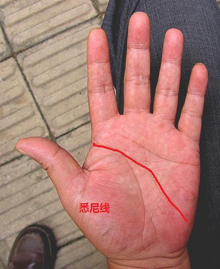 悉尼线:智慧线延长至打击缘直线叫悉尼线.