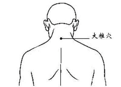 灸哥论穴:用艾灸疗法调理脑血栓