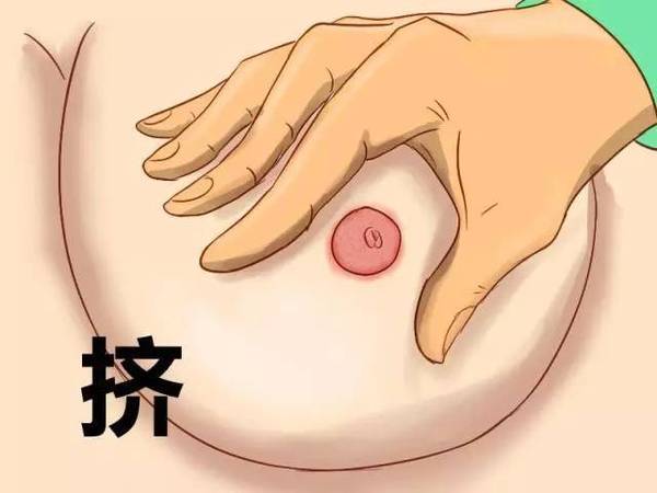 为什么月经前会乳房痛 a4mxew82904665701405.jpg
