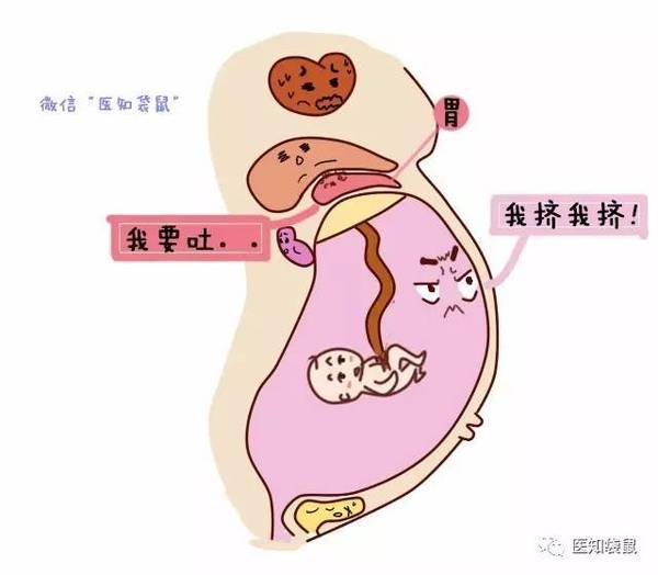 怎样缓解胃部疼痛 a2f1sw91314431381405.jpeg