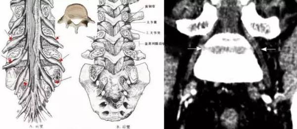 您一定经常看到腰5横突肥大,但怎么下诊断合适呢?