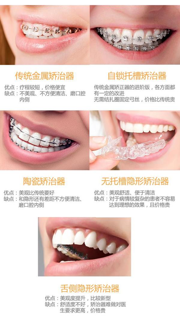带牙套要多少钱啊,有没有副作用?