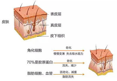 自由基是什么对皮肤有什么影响 a0ehzg9690893125619.jpg