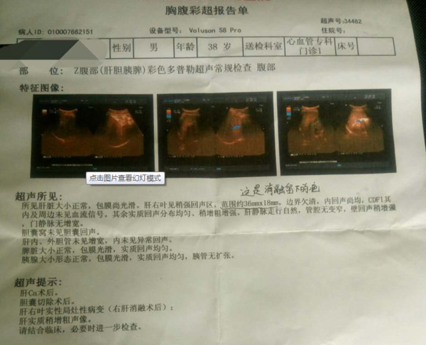 a6xeis6298656370542.jpg