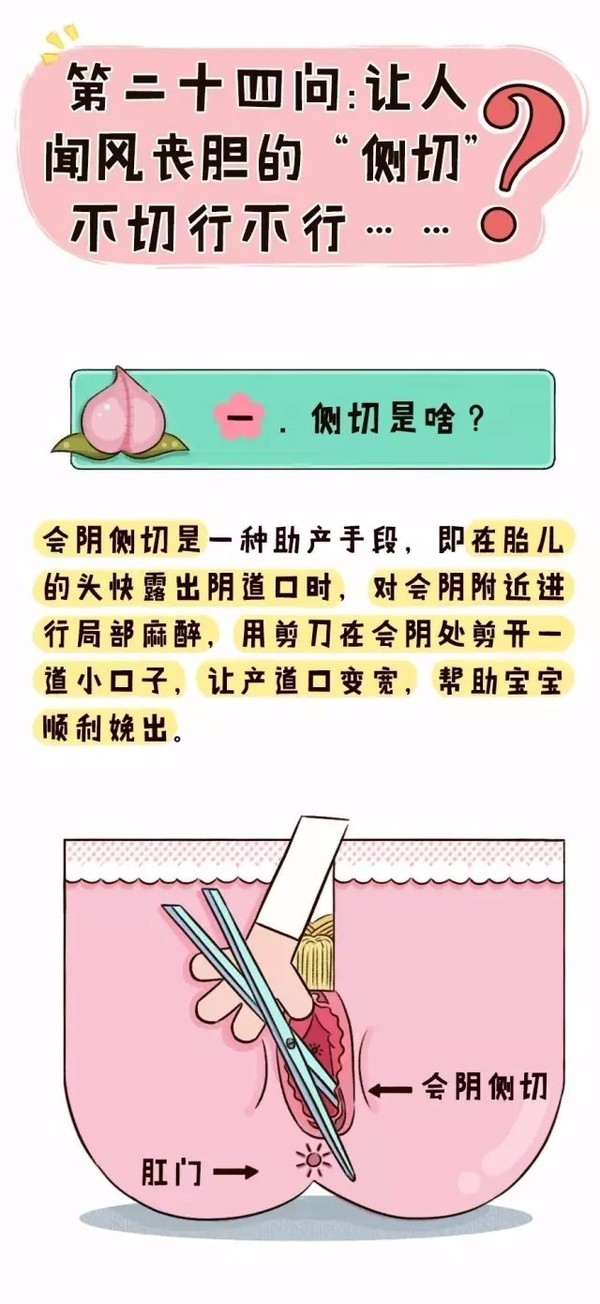 让人闻风丧胆的"侧切,不切行不行?