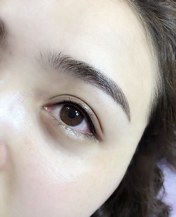 眼睛发雾是怎么回事,眼睛发雾是怎么回事?