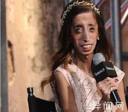 世界上最丑的女人是谁_世界上最瘦的人_世界