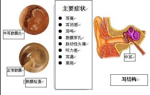 得了鼻炎不重视,鼻炎并发症让你后悔