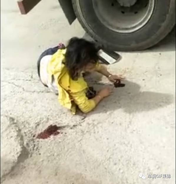 年轻女孩小腿被碾断,痛苦挣扎