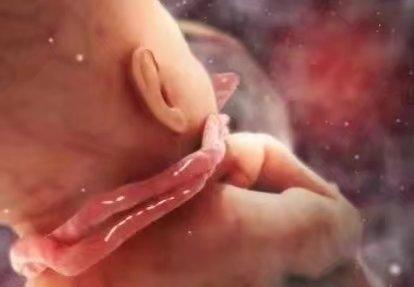 脐带绕颈怎么办? 孕妈记住这3招以助宝宝解除