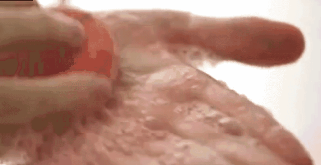 头发容易出油主要是因为洗头过勤,生活作息不规律导致头皮油脂分泌过