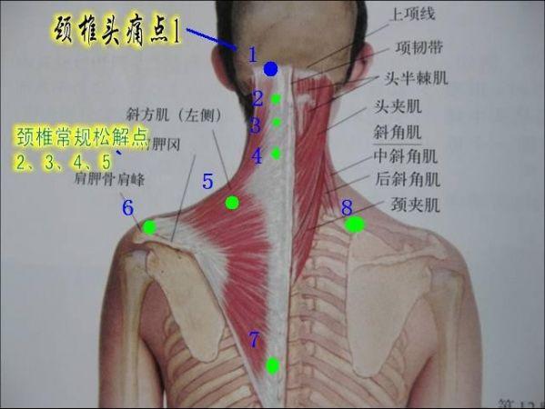 早期可有头颈,肩背部疼痛,有时疼痛剧烈.