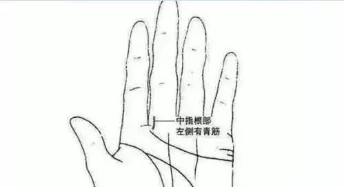 刮中指的"青筋",有效防治脑血栓(中老年参考)