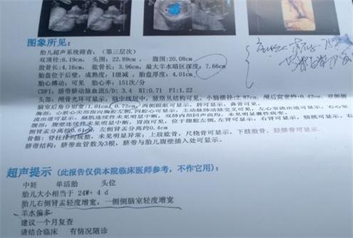 做四维时,医生常说的几句"暗语"生男生女,你都听懂了吗?