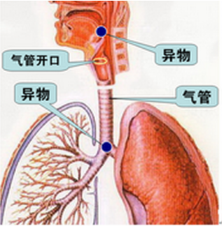 小儿气道透视x线异物检查首选动态dr-科技频道-手机搜狐小儿气道异物