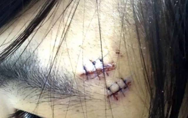 刘洁的去世,再次提醒我们:远离垃圾人-体育频道