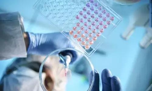 主力打压股价的目的