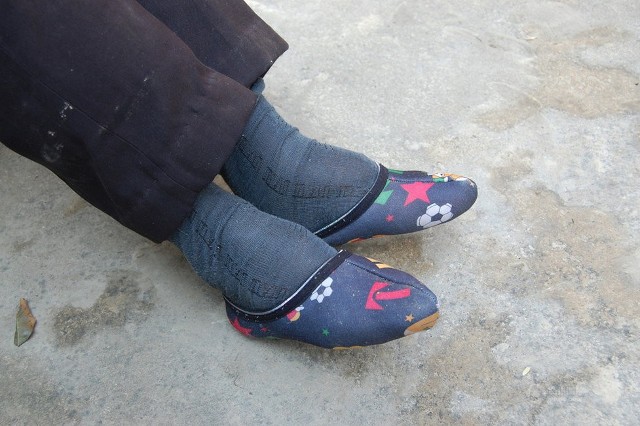 探访最后"三寸金莲"的小脚行走生活(组图)