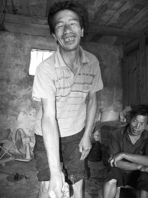 村民潘德宽"卖血"已有10年.长期采血,胳膊上留下疤痕.