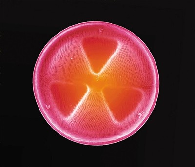复合聚焦显微镜下拍摄的癌细胞分裂过程