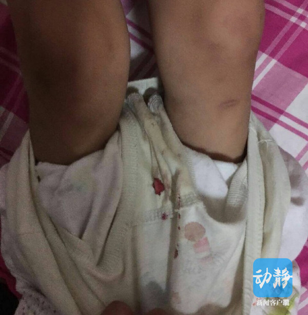 小名婷婷(化名),今年五岁,在平坝阳光小区附近的一所幼儿园读书,孩子