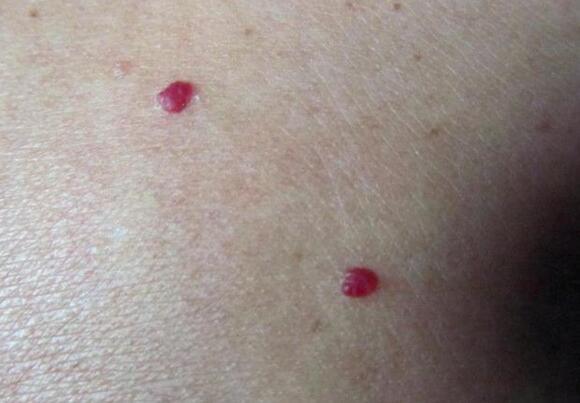 皮肤科的疾病比较有意思,都比较直观,大夫需要练就一双"火眼金睛"