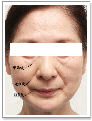 "三八线"让你老了不止10岁,这样做就对了!