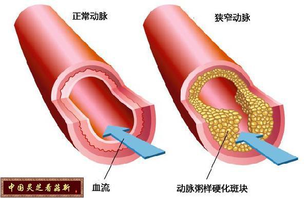 灵芝的7种功效及副作用 下篇 菇新说 健康频道 手机搜狐