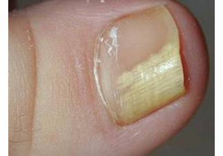 从指甲看出的问题,所有的人都应该自检一下