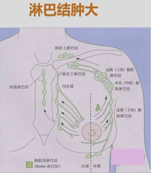 腋下淋巴结的位置图片图片
