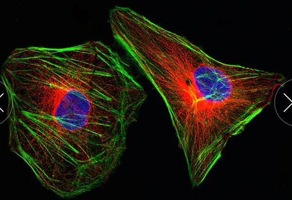 讲真，这20张癌症图片简直美翻了~-健康频道-手机搜狐