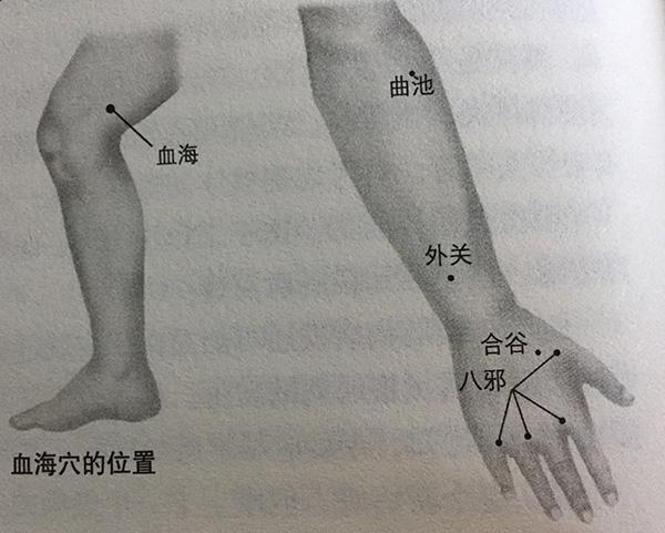 牛皮藓瘙痒难耐