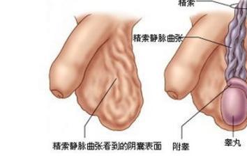 睾丸发生疼痛的原因 健康频道 手机搜狐 睾丸发生疼痛的原因 健康频道 手机搜狐
