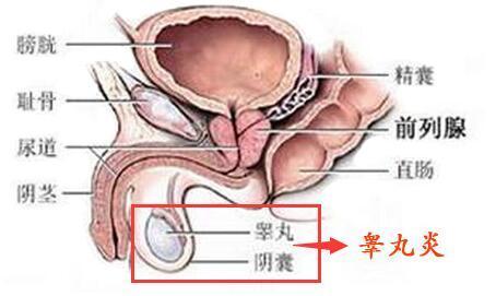 睾丸发生疼痛的原因 健康频道 手机搜狐