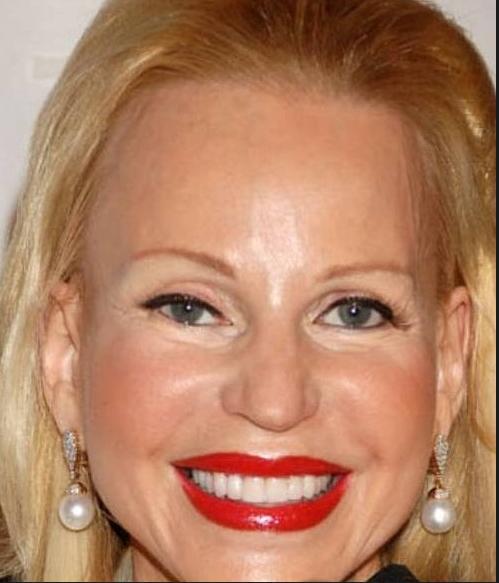 惨不忍睹!整容失败后的超恐怖照片大汇集