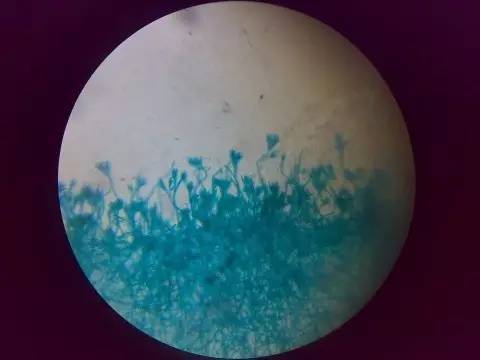 青霉素显微镜图片图片