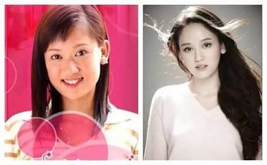 明星隆鼻前后对比照 鼻整形 看不出来才叫完美 新闻频道 手机搜狐