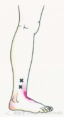 引起踝关节疼痛的十块肌肉 健康频道 手机搜狐