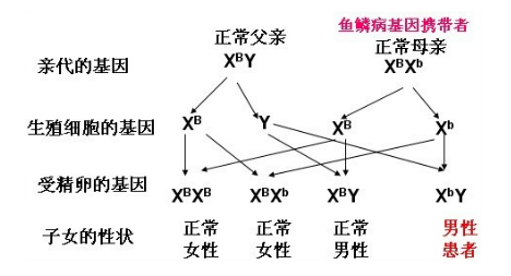 寻常型鱼鳞病会不会传染 健康频道 手机搜狐