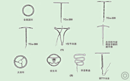 从医学的角度看,带上节育环10年以上会引起子宫内膜纤维化病变