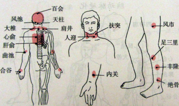 肩井,風池,陽溪,內關,脾俞,腎俞,肝俞,委中,足三里,陽陵泉,懸鐘,太溪