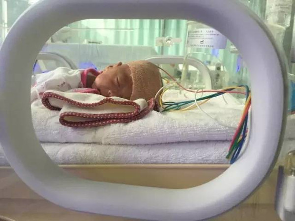 仅21周 6天,世界最小胎龄宝宝创造生命奇迹!看完哭了