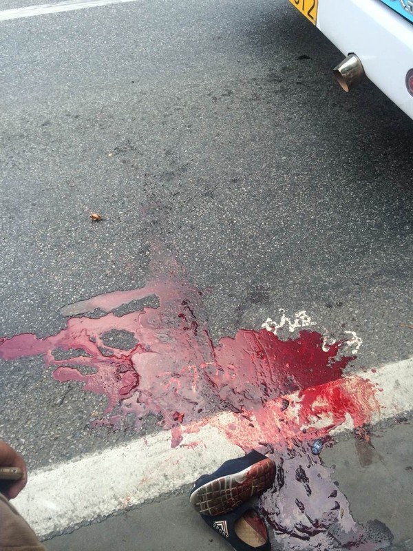 南京一公交站台发生交通事故,男子双腿断裂,现场血迹斑斑!原因是