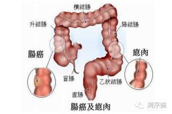 口腔细菌如何使大肠癌恶化 科技频道 手机搜狐