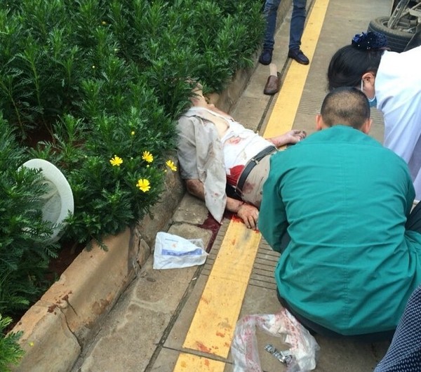 今日上午,玉湖路上发生一起车祸!一60岁老人手脚折断,伤情严重!