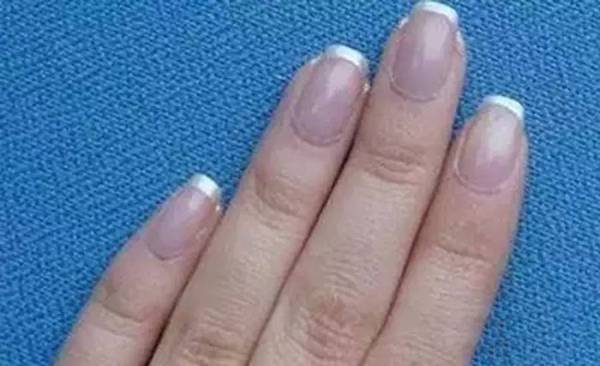 指甲发蓝,显示肺部受阻. 3 指甲太薄