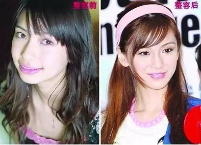 怎么评价安吉拉贝贝杨颖关于整容的种种猜测.